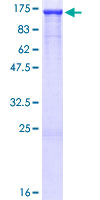 Recombinant Human HIP1 protein