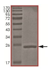 Recombinant Human HIP2/LIG protein