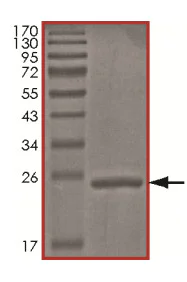 SDS-PAGE - Recombinant Human HIP2/LIG protein (AB156061)