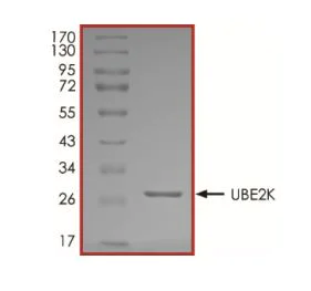 SDS-PAGE - Recombinant human HIP2/LIG protein (Active) (AB269104)