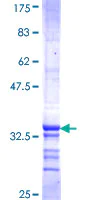 SDS-PAGE - Recombinant Human HIST1H2AK protein (AB159993)