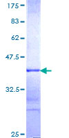Recombinant Human Histone acetyltransferase MYST3/MOZ protein