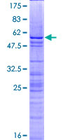 Recombinant Human Histone H1.0 protein