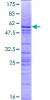 SDS-PAGE - Recombinant Human Histone H1.0 protein (GST tag N-Terminus) (AB158626)