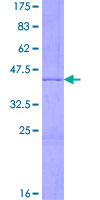 SDS-PAGE - Recombinant Human Histone H3 protein (AB166242), expandable thumbnail