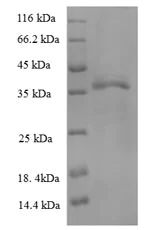 SDS-PAGE - Recombinant Human HLA B protein (His tag) (AB225646)