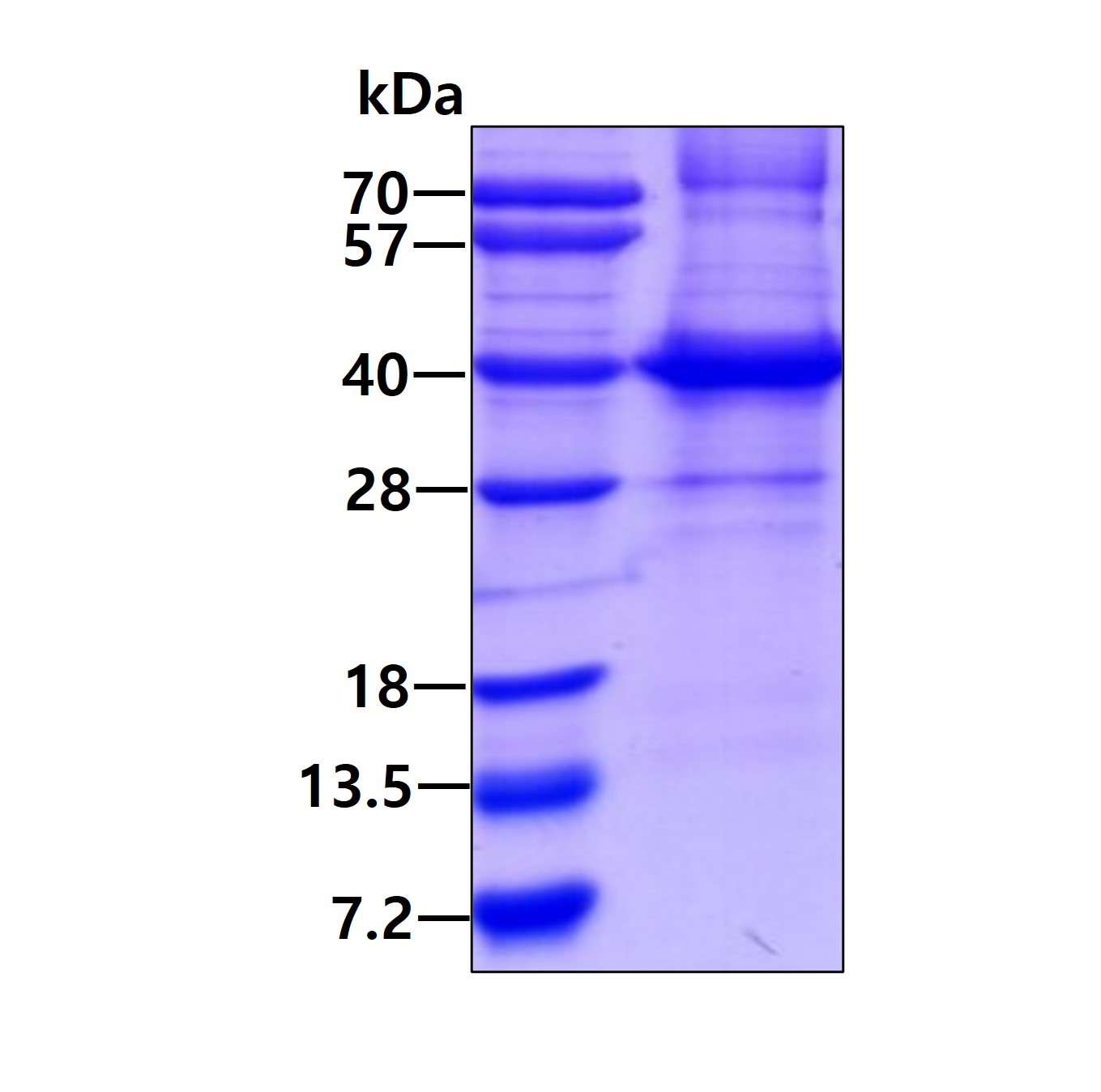 SDS-PAGE - Recombinant Human HLA-C protein (AB167868)