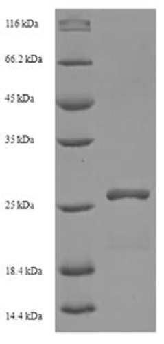 SDS-PAGE - Recombinant Human HLA-DMA protein (His tag) (AB237672), expandable thumbnail