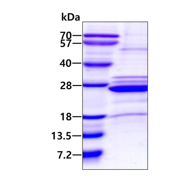 SDS-PAGE - Recombinant Human HLA-DOA protein (denatured) (His tag N-Terminus) (AB167908)