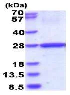 SDS-PAGE - Recombinant Human HLA DOB protein (denatured) (AB180287)