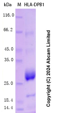 SDS-PAGE - Recombinant Human HLA-DPB1 Protein Standard (AB323088)