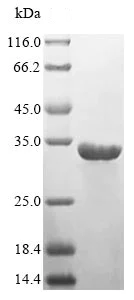 SDS-PAGE - Recombinant Human HLA-DR protein (His tag) (AB237748)