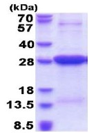 SDS-PAGE - Recombinant Human HLA-DR protein (His tag N-Terminus) (AB177661)