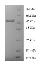 SDS-PAGE - Recombinant Human HLA E protein (Tagged) (AB235846)