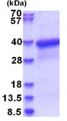 SDS-PAGE - Recombinant Human HLA F protein (His tag N-Terminus) (AB181899)