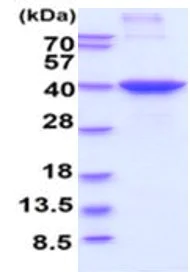 SDS-PAGE - Recombinant Human HLA G protein (His tag) (AB224888)