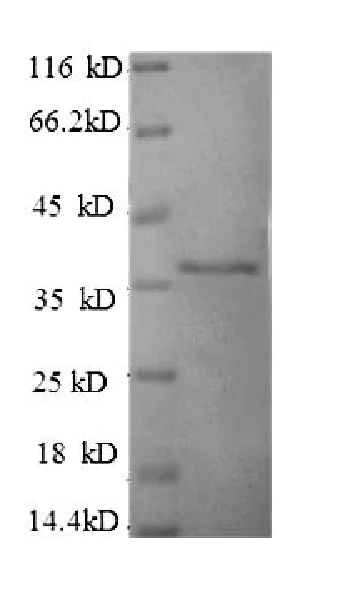SDS-PAGE - Recombinant Human HLA G protein (His tag) (AB225660)