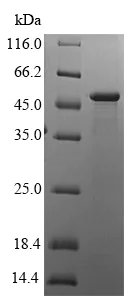 SDS-PAGE - Recombinant Human HLA G protein (Tagged) (AB224851)