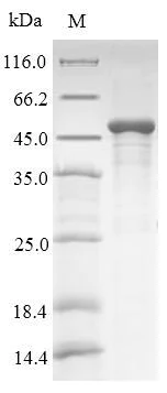 SDS-PAGE - Recombinant Human HLA G protein (Tagged) (AB240860)