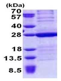 SDS-PAGE - Recombinant Human HMG4 protein (His tag N-Terminus) (AB167851)