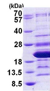 SDS-PAGE - Recombinant Human HMGA2 protein (His tag C-Terminus) (AB156333)