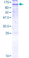 SDS-PAGE - Recombinant Human HMGCR protein (AB132810)