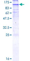 SDS-PAGE - Recombinant Human HMGCR protein (GST tag N-Terminus) (AB132810)