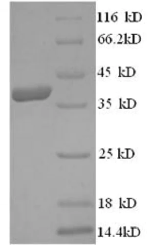 SDS-PAGE - Recombinant Human HMGCR protein (His tag) (AB235714)