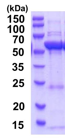 SDS-PAGE - Recombinant Human HMGCS1 protein (AB201881)