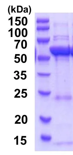 SDS-PAGE - Recombinant Human HMGCS1 protein (His tag N-Terminus) (AB201881)