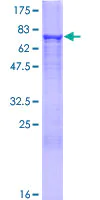 SDS-PAGE - Recombinant Human HMGCS2 protein (AB114900)