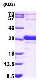 SDS-PAGE - Recombinant Human HMGE protein (His tag N-Terminus) (AB101203)