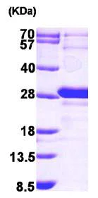 SDS-PAGE - Recombinant Human HMGE protein (His tag N-Terminus) (AB101203)