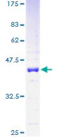 SDS-PAGE - Recombinant Human HMGN1 protein (GST tag N-Terminus) (AB112301)