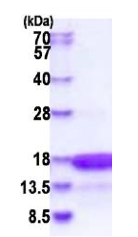 SDS-PAGE - Recombinant Human HMGN3 protein (His tag N-Terminus) (AB183234)