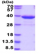 Recombinant human HMT protein (Active)