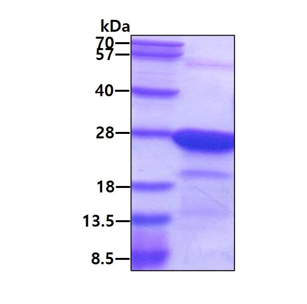 SDS-PAGE - Recombinant Human HN1L/L11 protein (His tag N-Terminus) (AB139791)