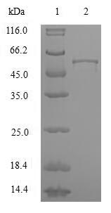 SDS-PAGE - Recombinant Human hnRNP A2B1 protein (AB224866)