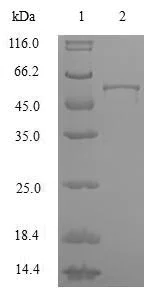 SDS-PAGE - Recombinant Human hnRNP A2B1 protein (AB224866)