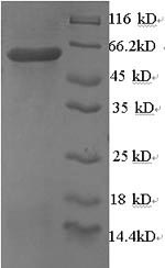 SDS-PAGE - Recombinant Human hnRNP A2B1 protein (Tagged) (AB235707), expandable thumbnail