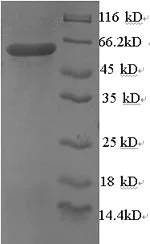 SDS-PAGE - Recombinant Human hnRNP A2B1 protein (Tagged) (AB235707)