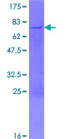 SDS-PAGE - Recombinant Human hnRNP D/AUF1 protein (AB152450)
