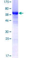 SDS-PAGE - Recombinant Human hnRNP F protein (AB114680)