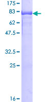 SDS-PAGE - Recombinant Human hnRNP K protein (AB132460), expandable thumbnail