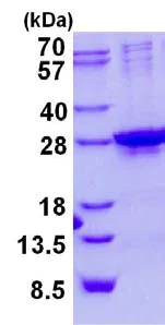 SDS-PAGE - Recombinant Human Homeobox protein SIX6 (His tag N-Terminus) (AB134617)