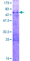 SDS-PAGE - Recombinant Human HOXA11 protein (AB158672), expandable thumbnail