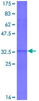 Recombinant Human HOXA5 protein