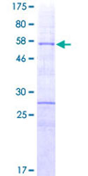SDS-PAGE - Recombinant Human HOXA9 protein (AB152453), expandable thumbnail