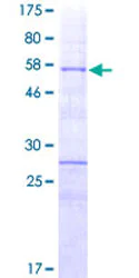 SDS-PAGE - Recombinant Human HOXA9 protein (AB152453)