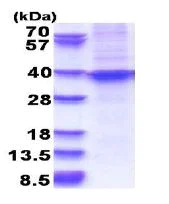 SDS-PAGE - Recombinant Human HOXA9 protein (denatured) (AB180306)